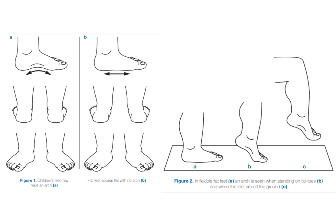 Why Should Babies Wear Soft-Soled Shoes?
