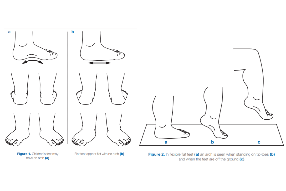 Why Should Babies Wear SoftSoled Shoes?