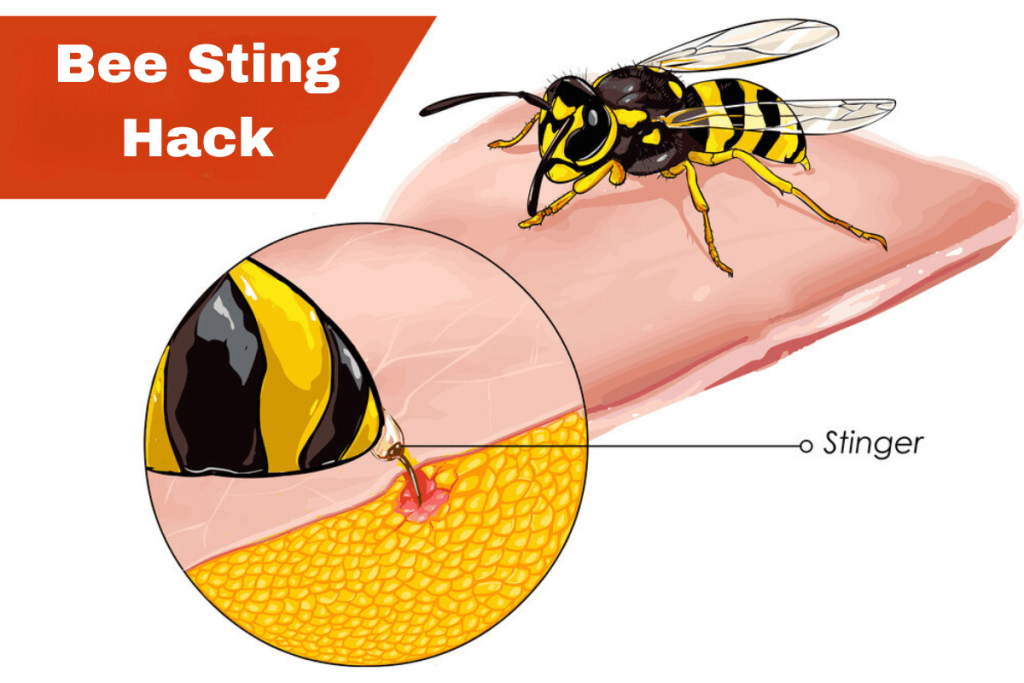Bee sting hack illustration: close-up of stinger injecting venom into skin