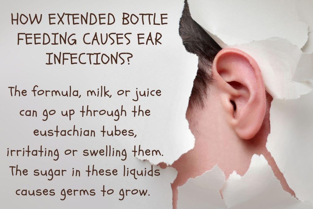 Can bottle feeding cause ear infections?